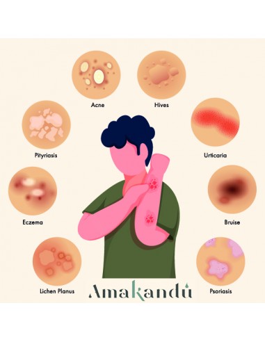 Bálsamo CBD + Ácido Hialurónico